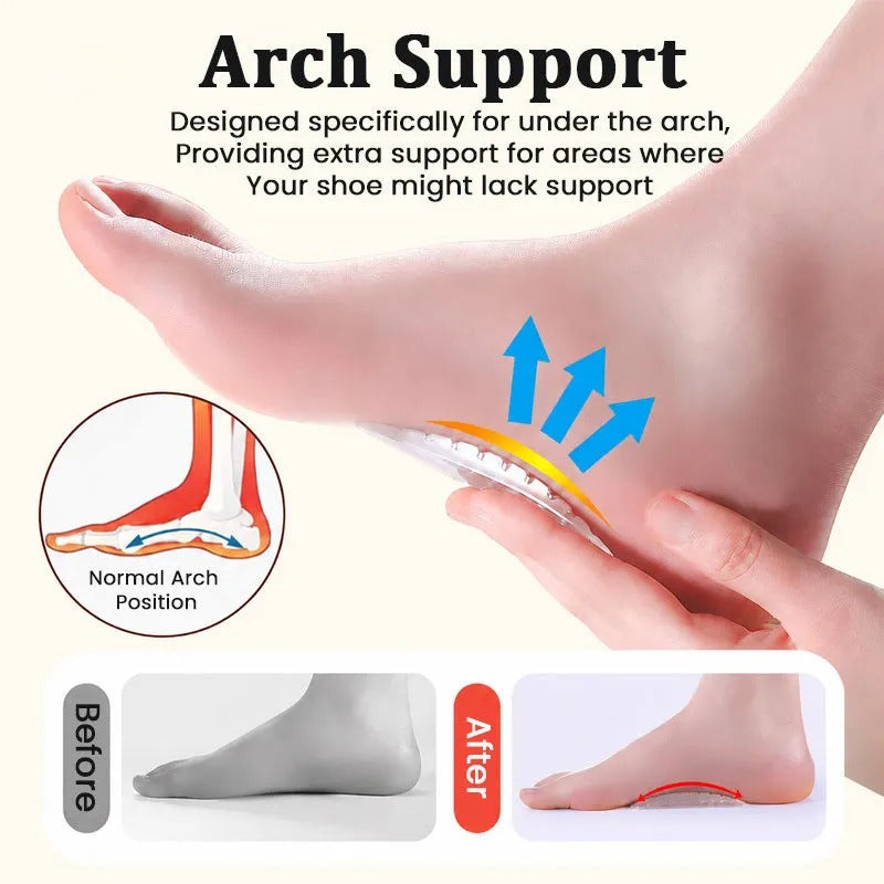 Clear arch support positioned beneath the natural arch